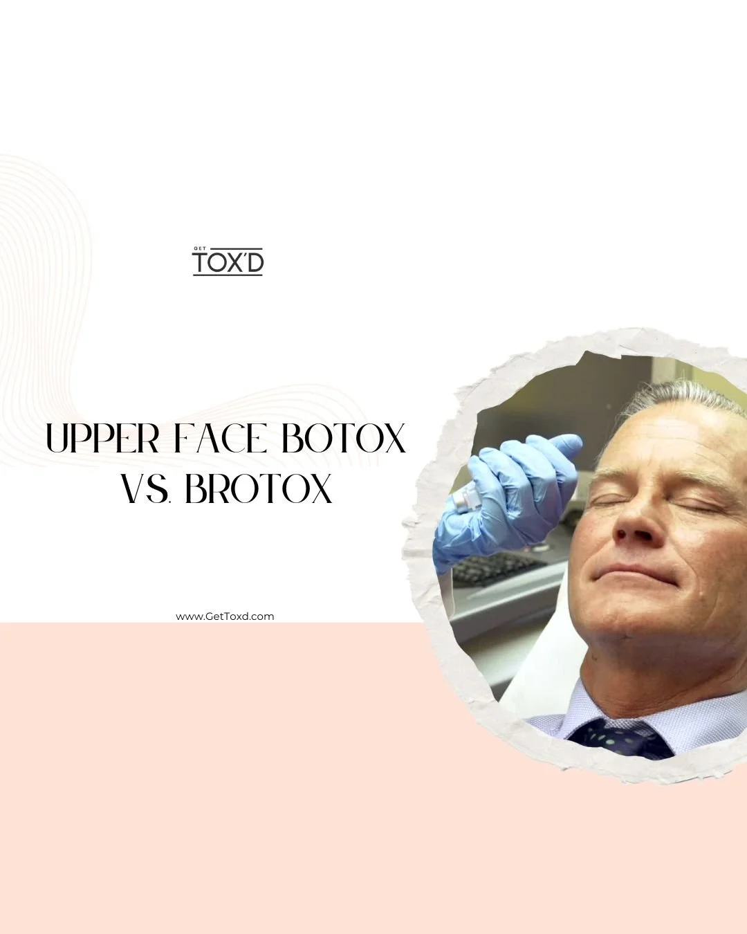 Upper Face Botox vs. Brotox: How Men Can Choose the Right Treatment?