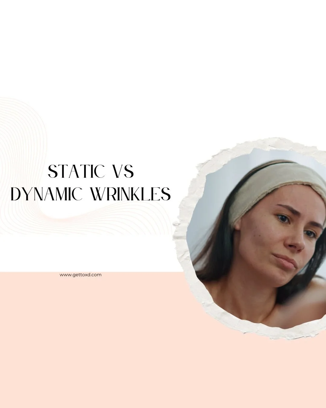Static & Dynamic Wrinkles: Botox & Your Skin