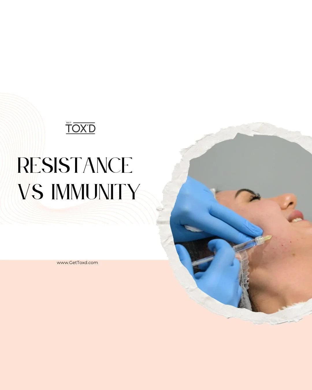 Understanding Botox Resistance vs Immunity