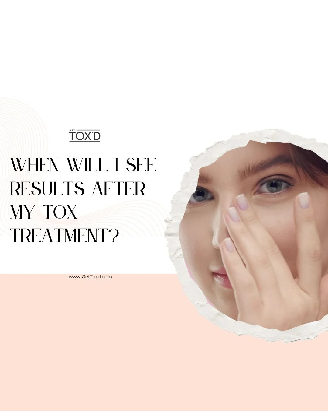 When Will I See Results After My Tox Treatment?