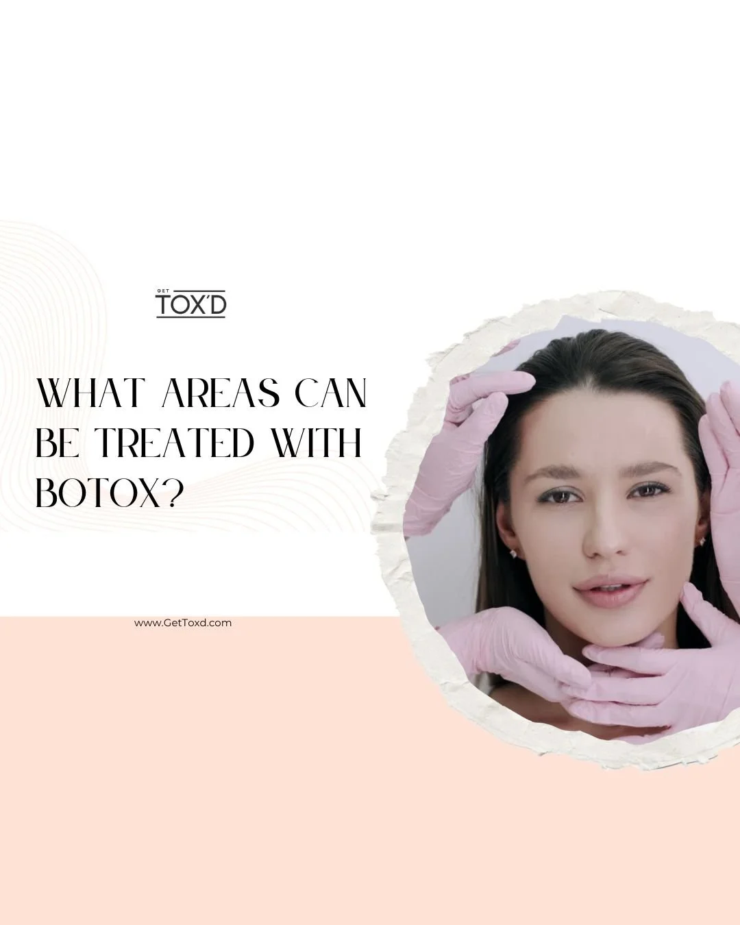 What Areas Can Be Treated with Botox