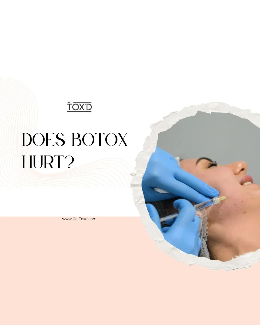 Does Botox Hurt?