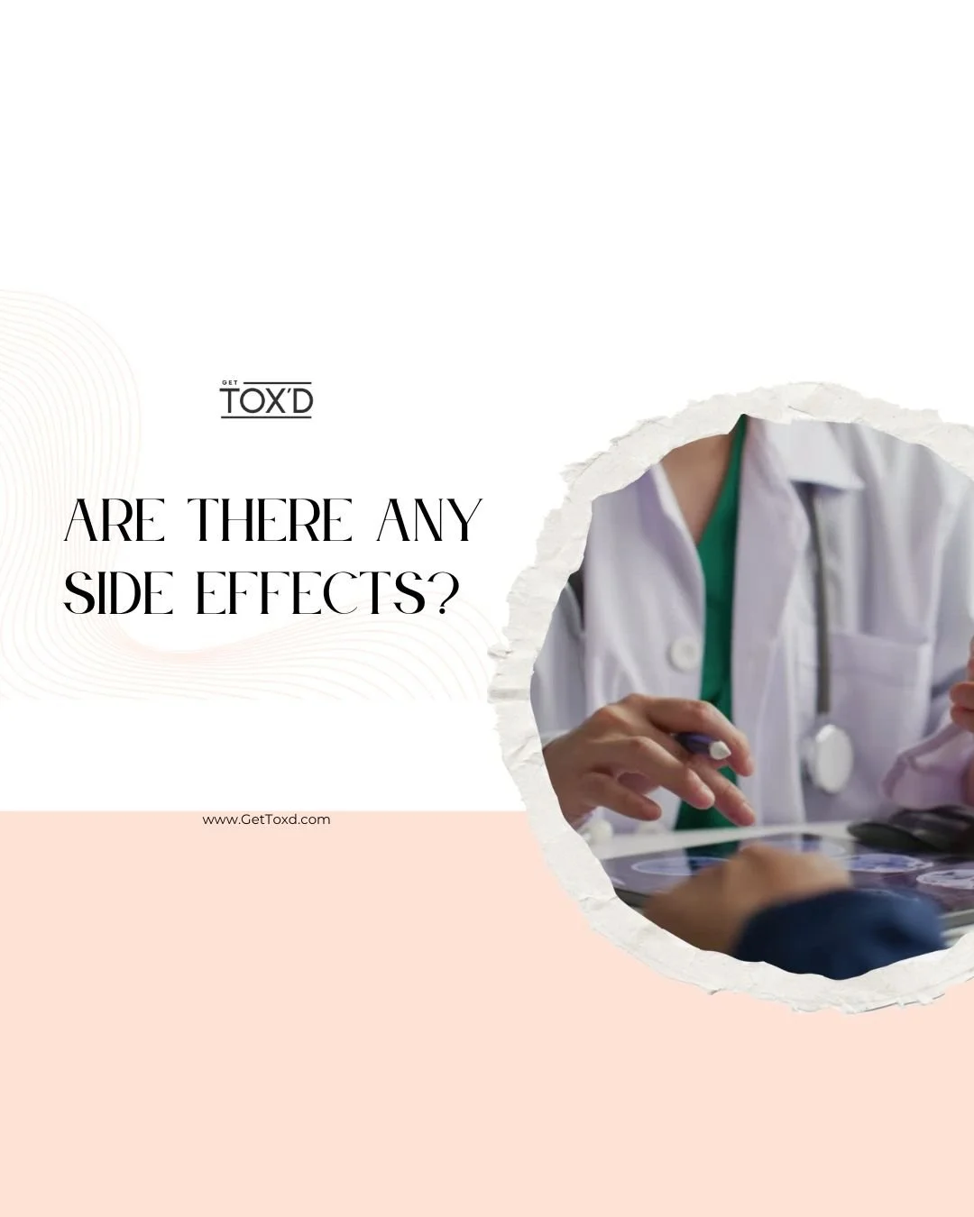 Does Botox Have Side Effects?