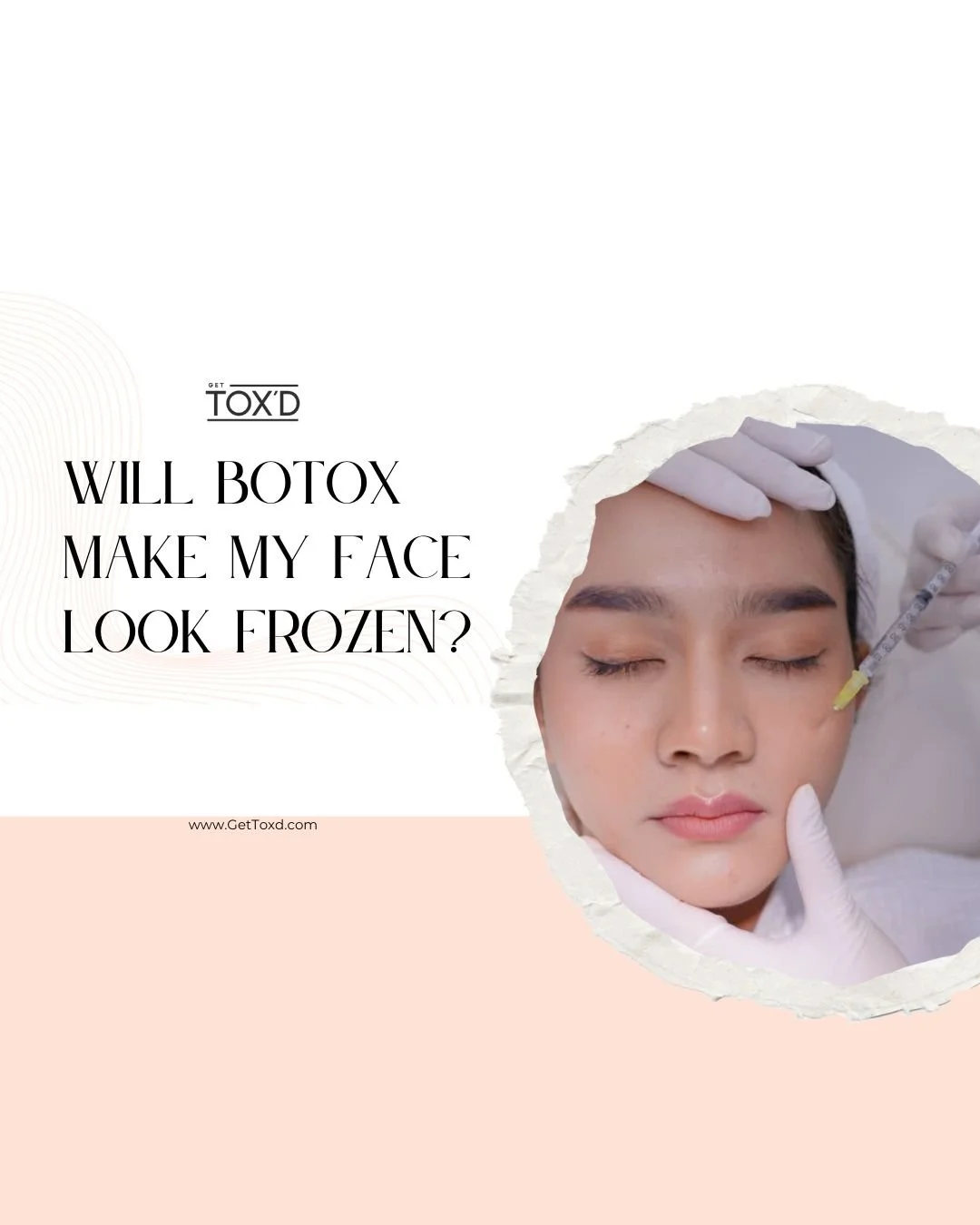 Will Botox Make My Face Look Frozen?