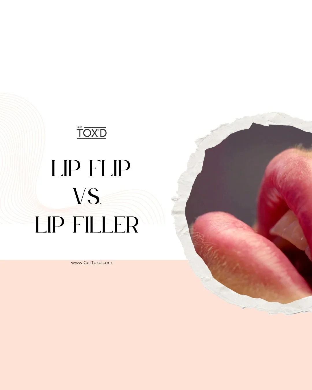 Lip Filler vs. Lip Flip: Which One Is Right for You?