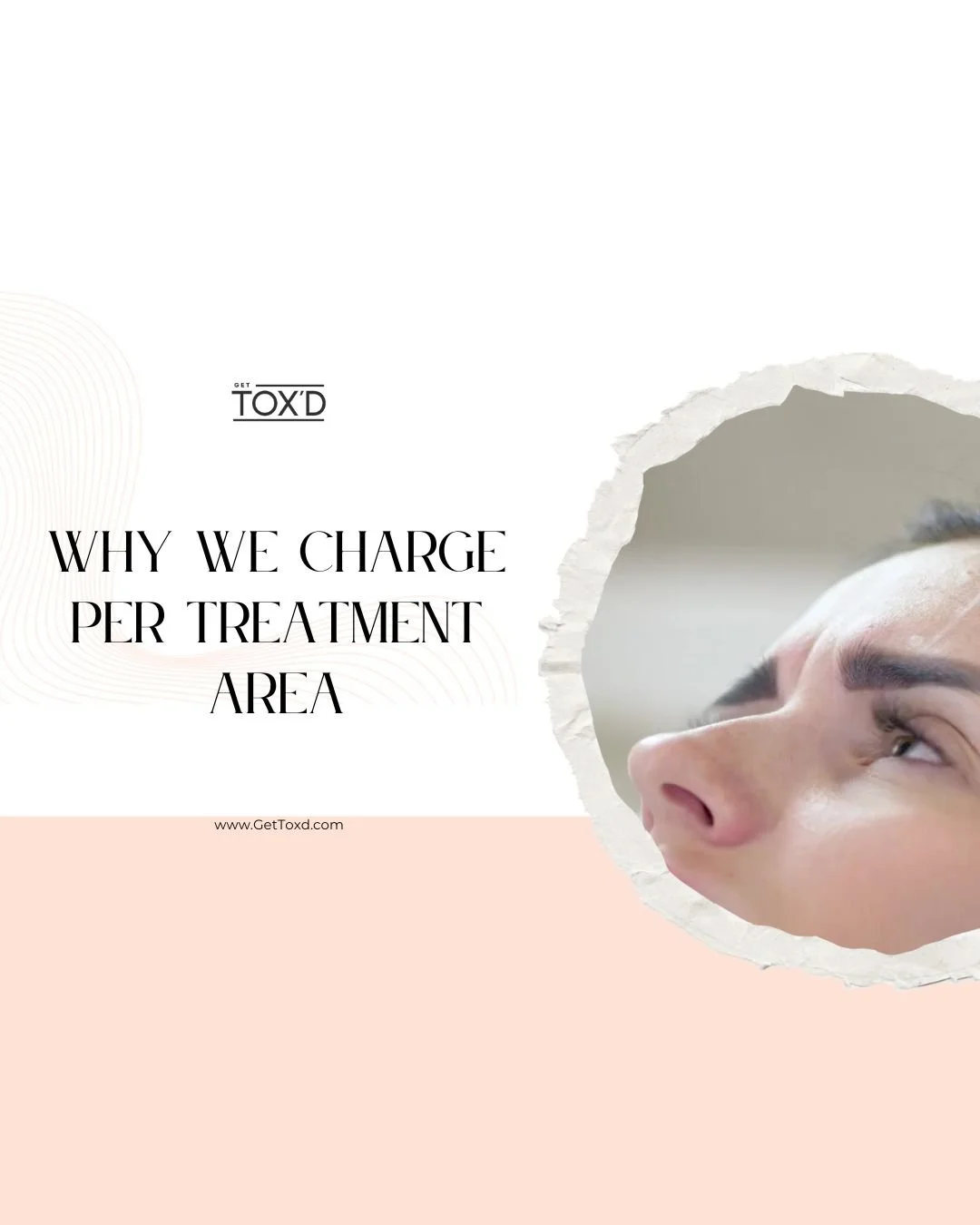 Botox Pricing Explained: Why We Charge Per Treatment Area