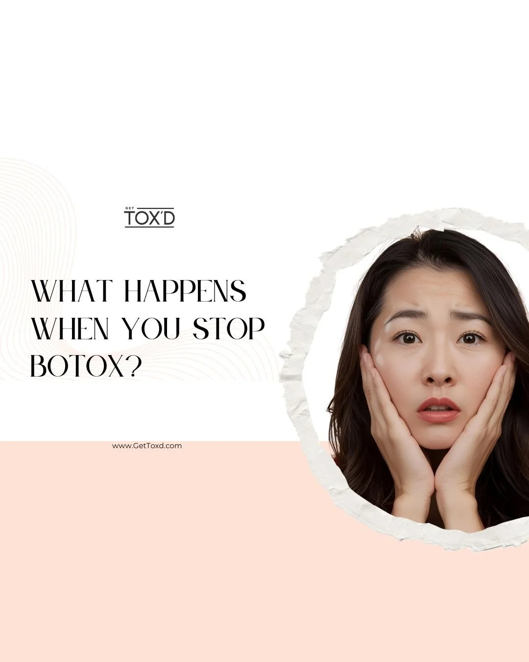 What Happens When You Stop Botox?