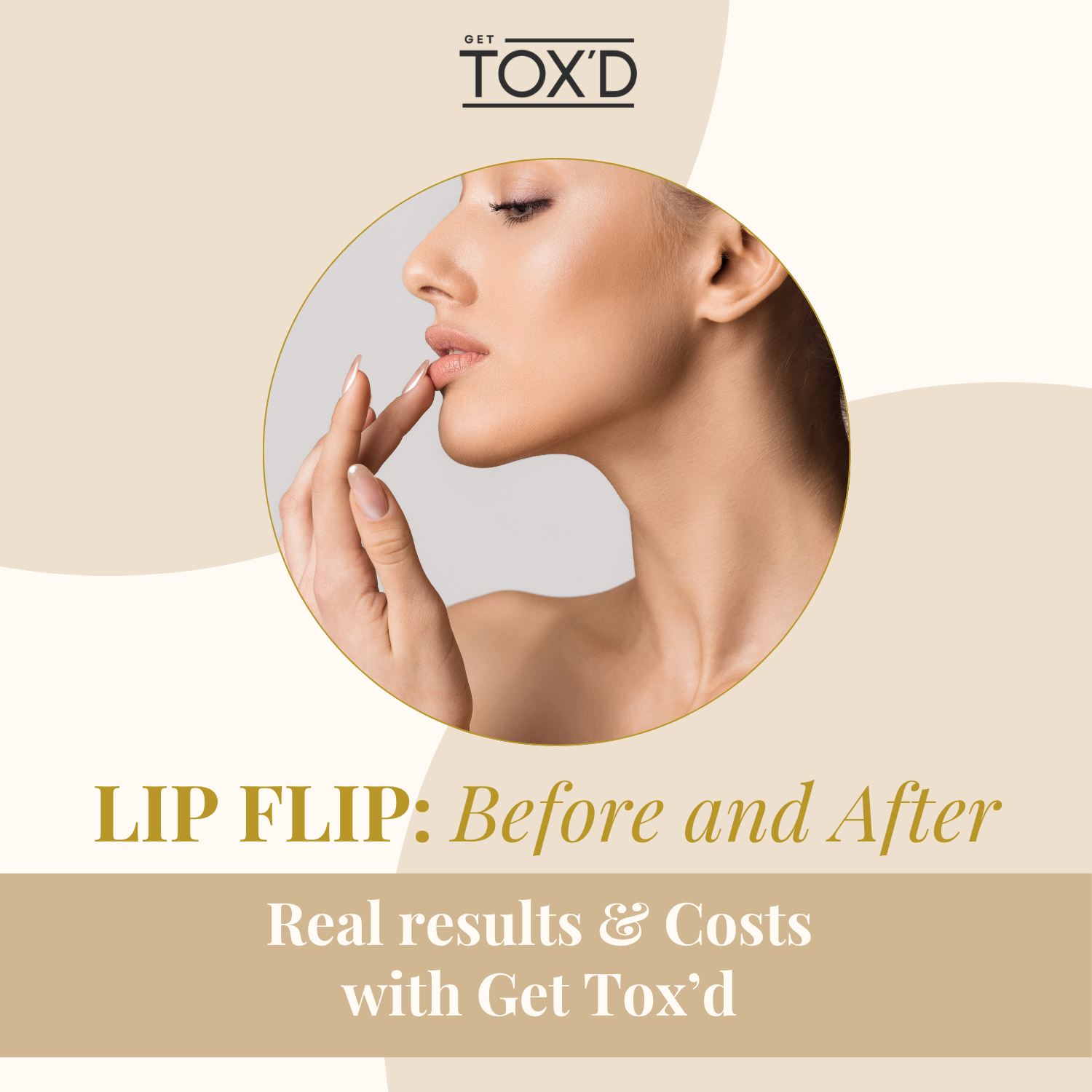 Lip flip before and after: real results &amp; costs with Get Tox’d&nbsp;