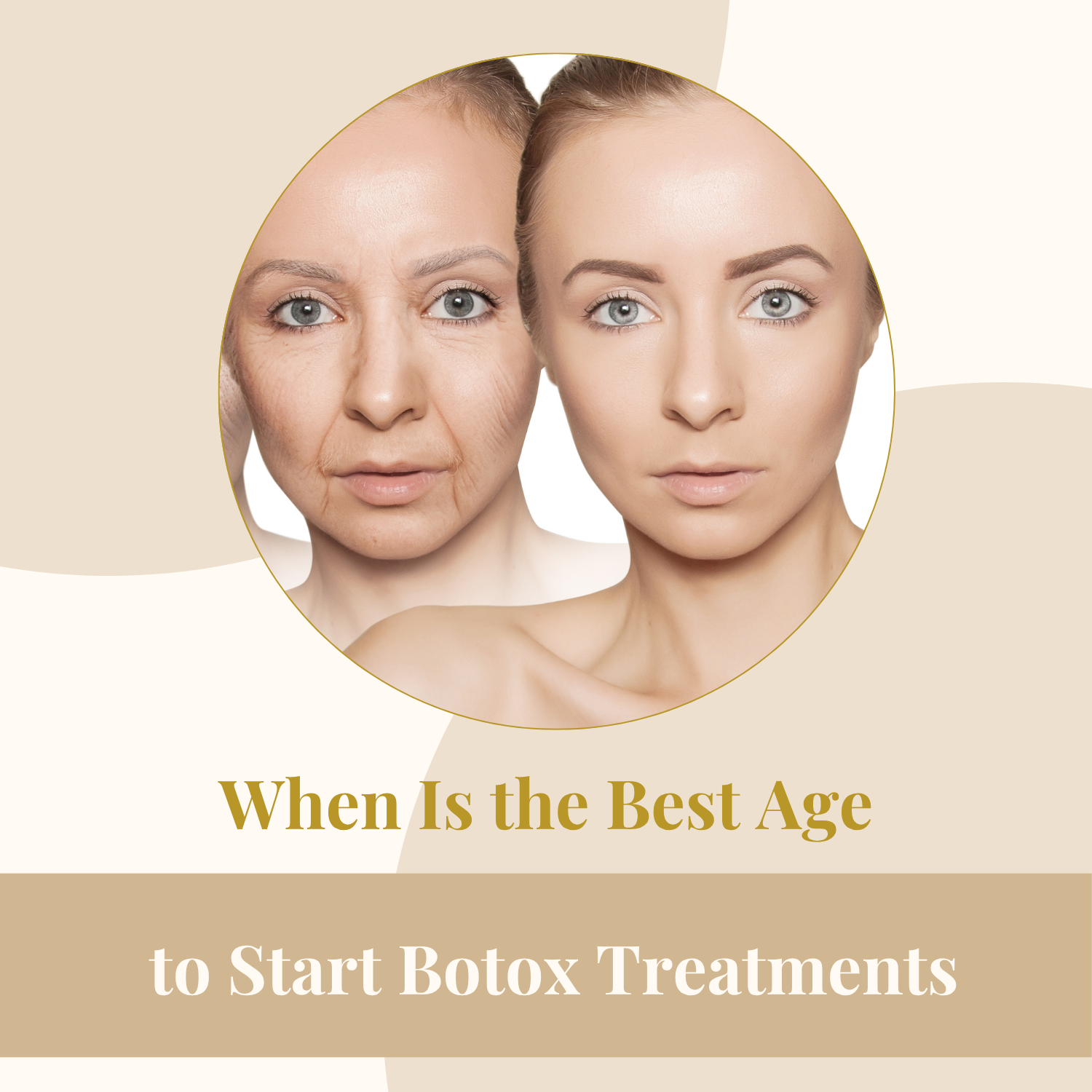 When Is the Best Age to Start Botox Treatments