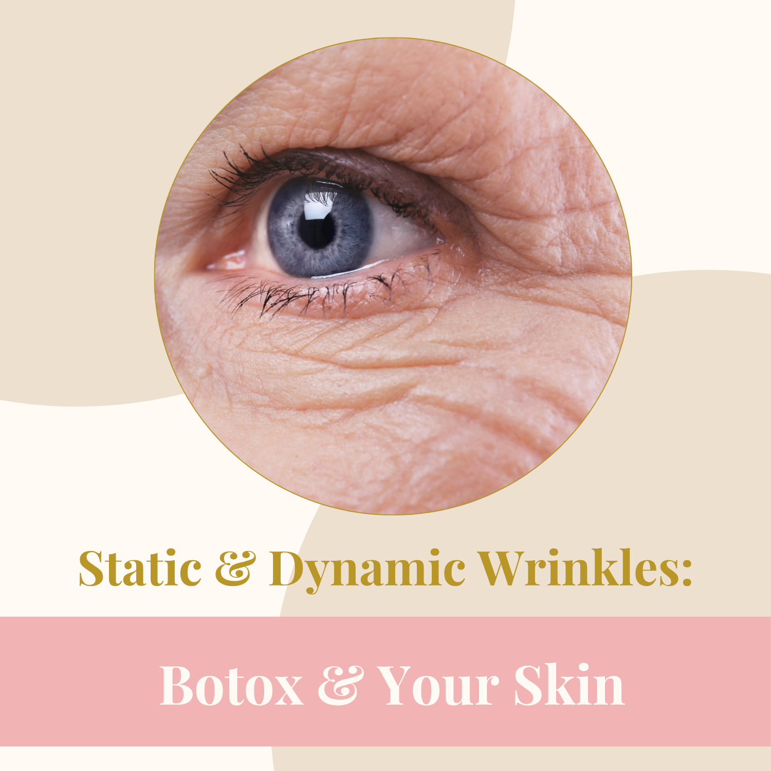 Static &amp; Dynamic Wrinkles: Botox &amp; Your Skin