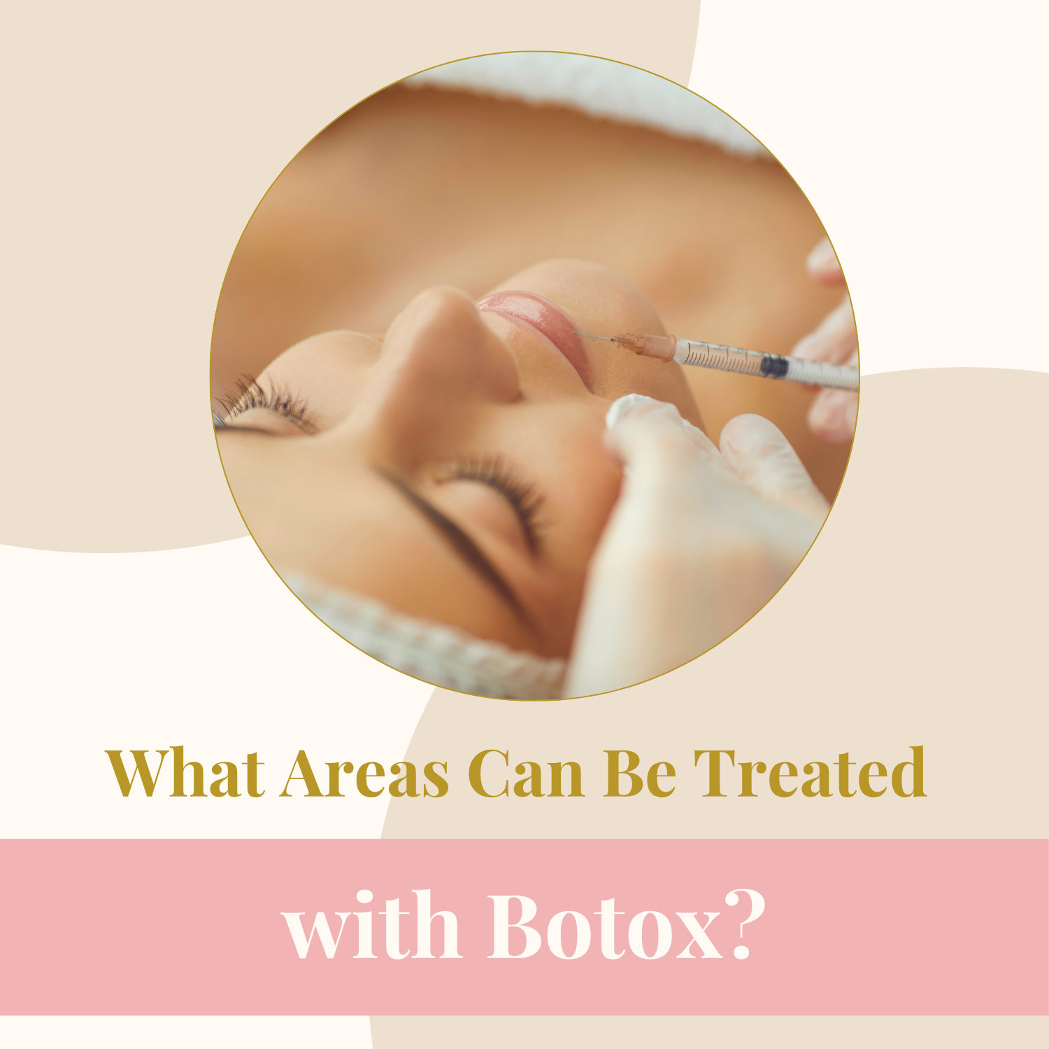 What Areas Can Be Treated with Botox