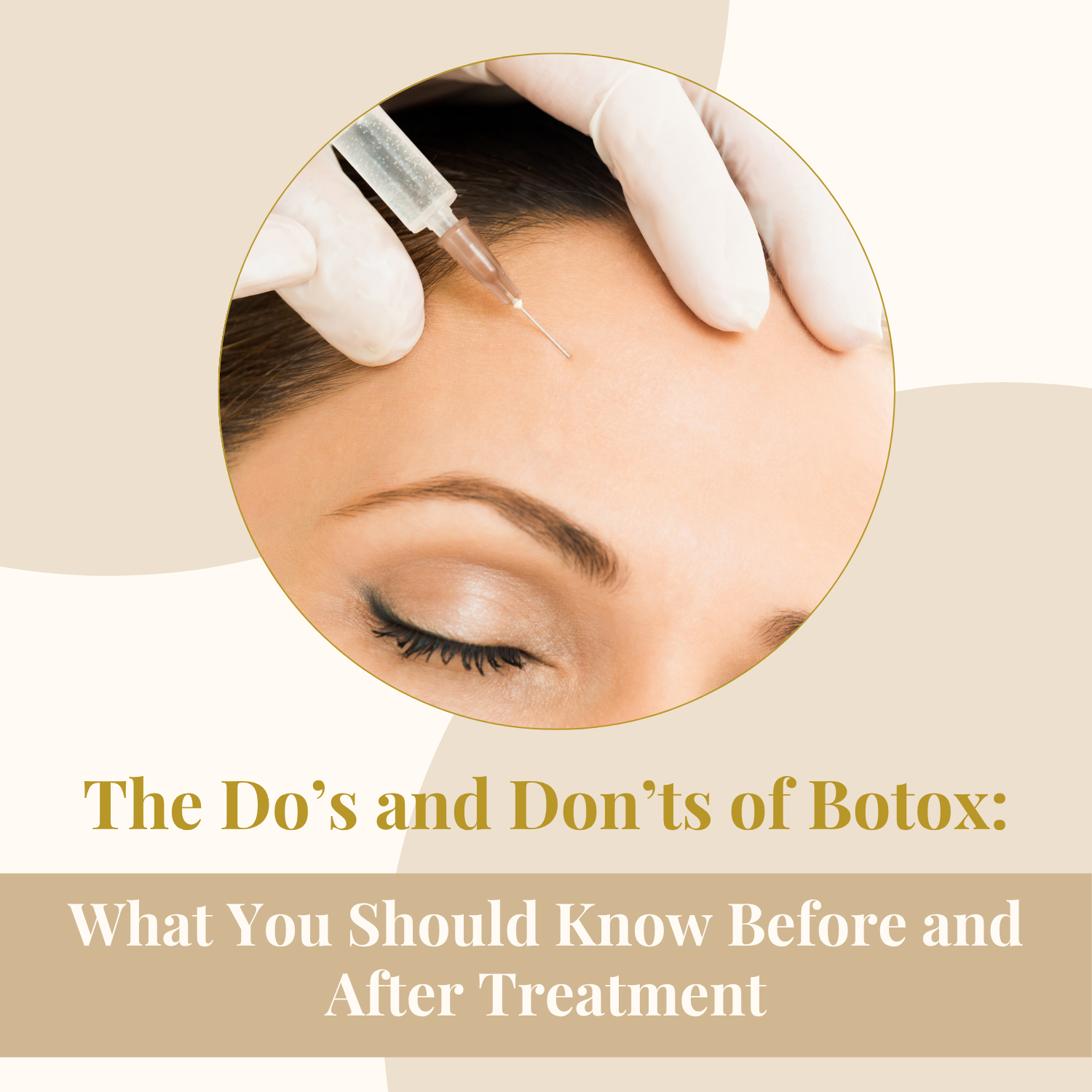 The Do’s and Don’ts of Botox: What You Should Know Before and After Treatment