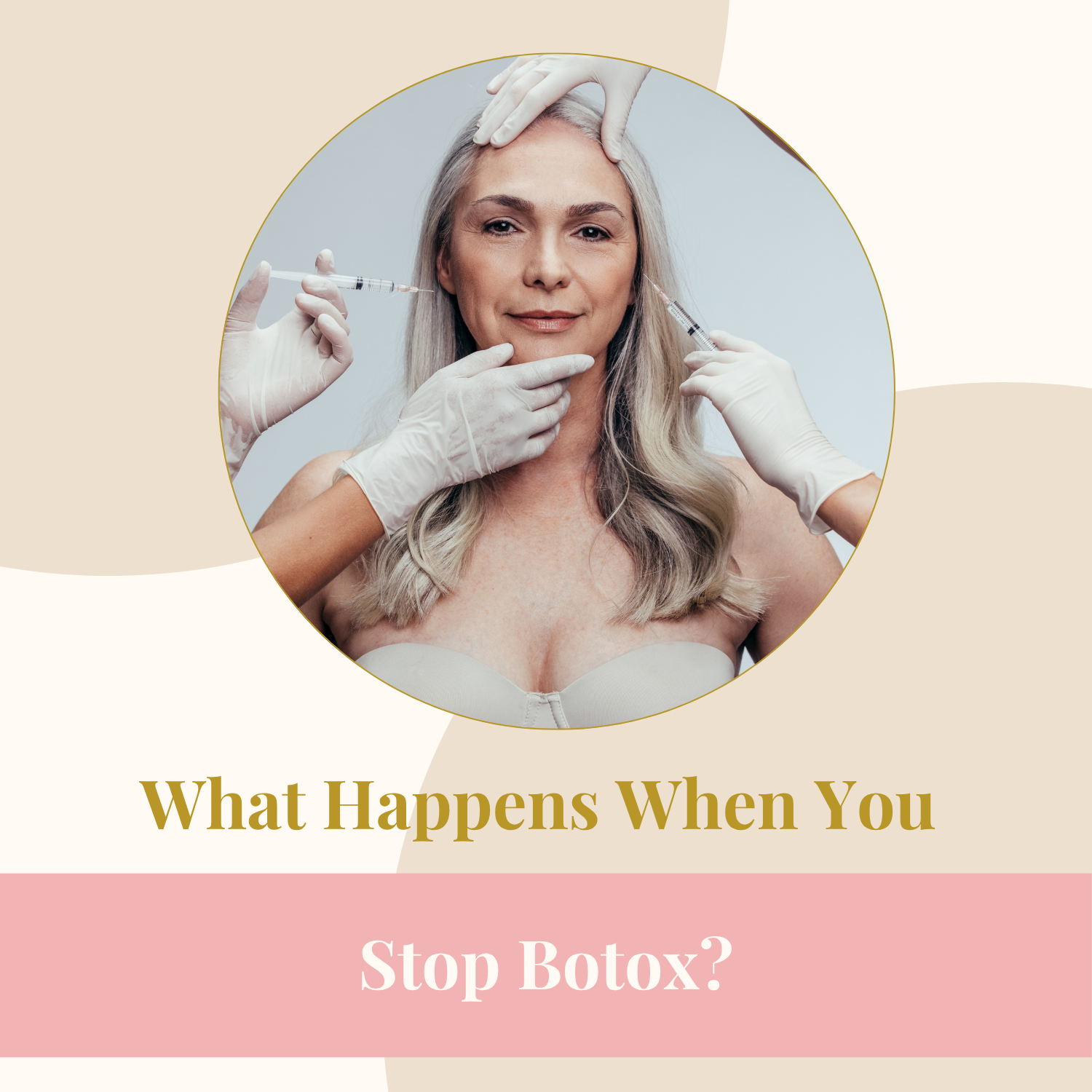 What Happens When You Stop Botox?