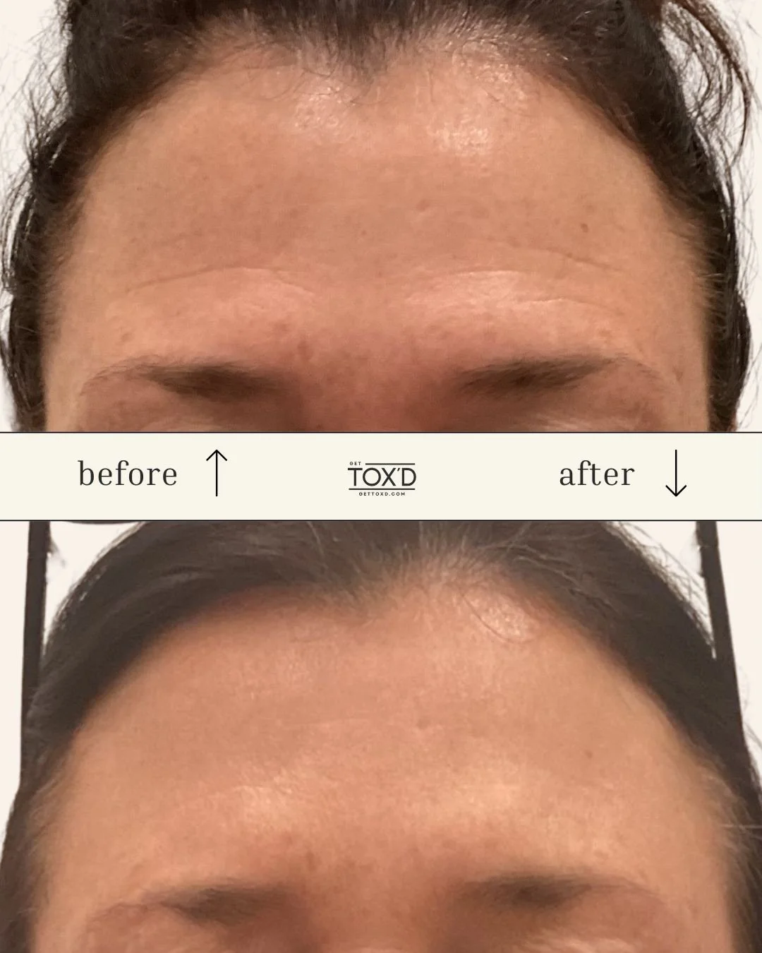 ✨ Smooth, refreshed, and beautifully natural m, that&rsquo;s the Get Tox&rsquo;d experience.

💉 Our licensed nurse injectors use precision techniques tailored to each client, creating soft, balanced, and subtle enhancements.

🤍 Houston keeps choosi