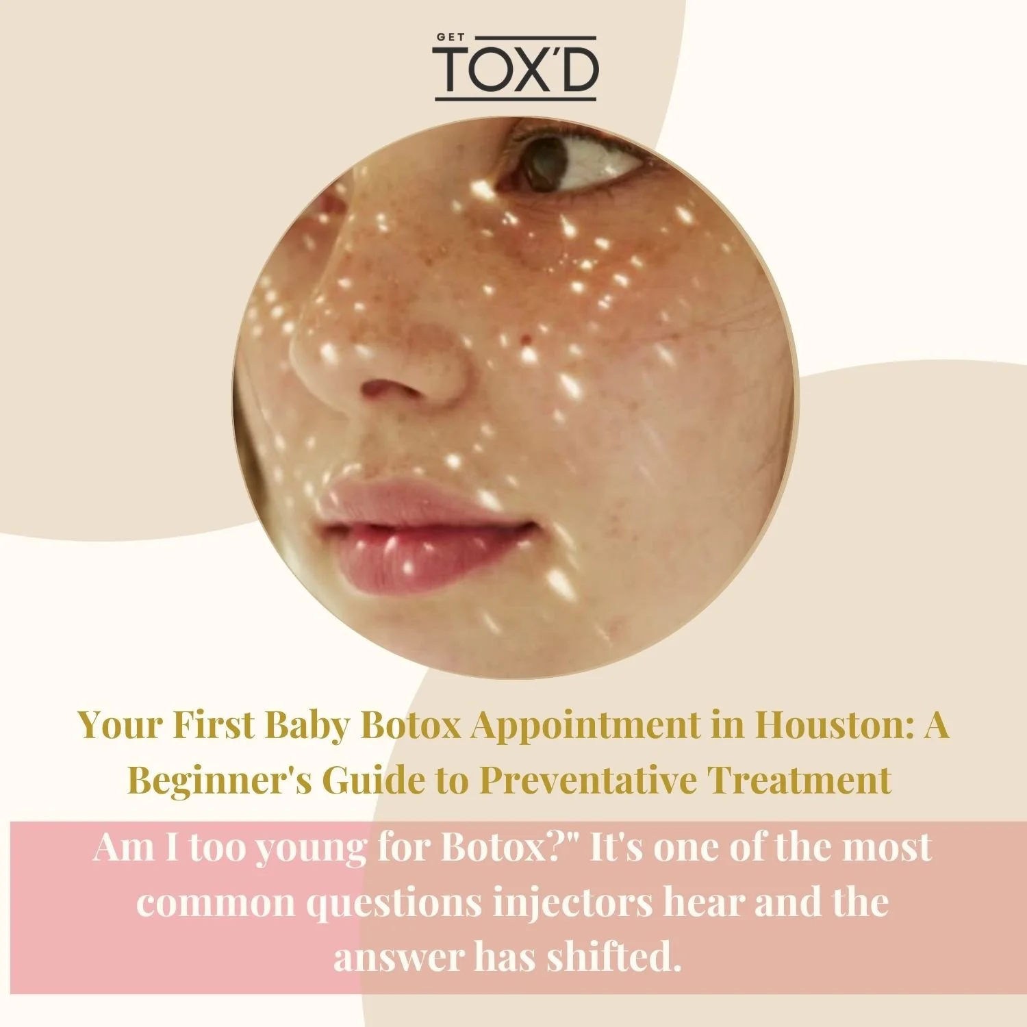Baby Botox in Houston: A Beginner’s Guide