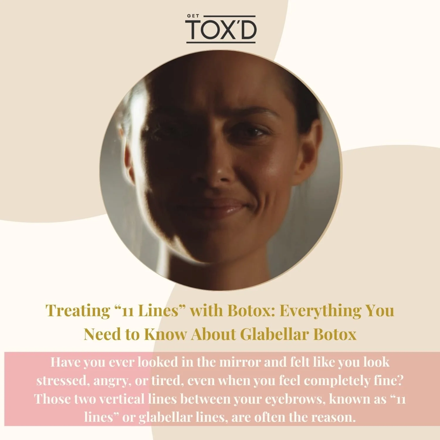 Treating “11 Lines” with Botox: Everything You Need to Know About Glabellar Botox