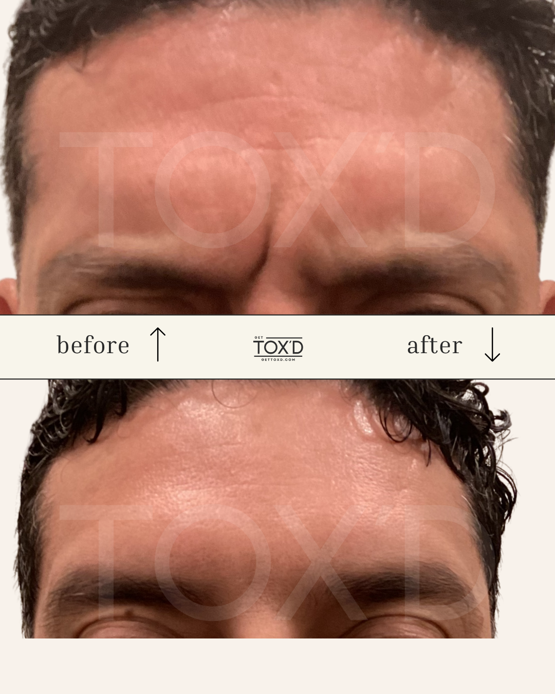 Tox’d (26).png