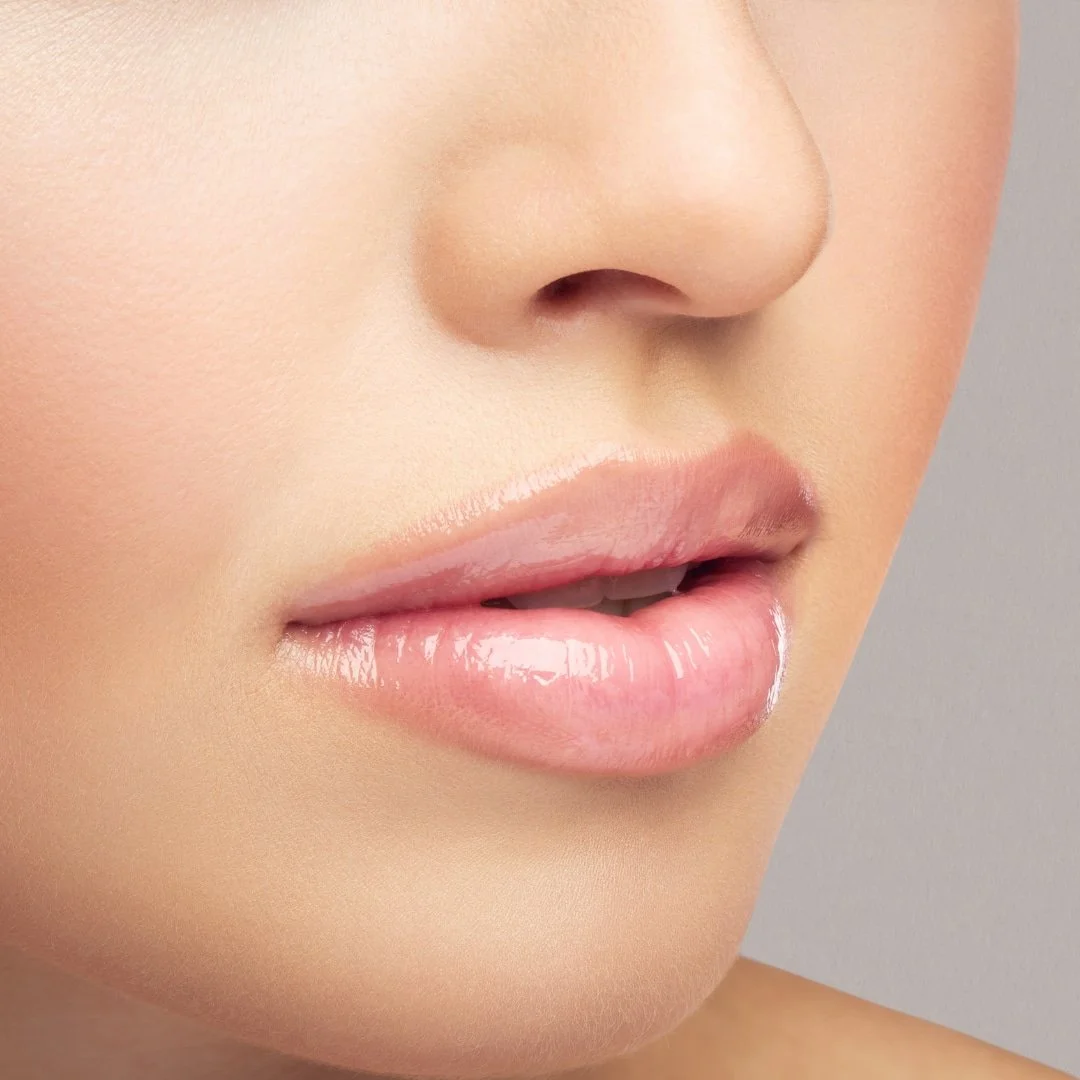 Lip Flip Botox treatment for upper lip enhancement
