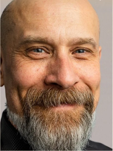 Brotox Botox in Houston for men at Get Tox’d Medspa, smoothing frown lines and forehead