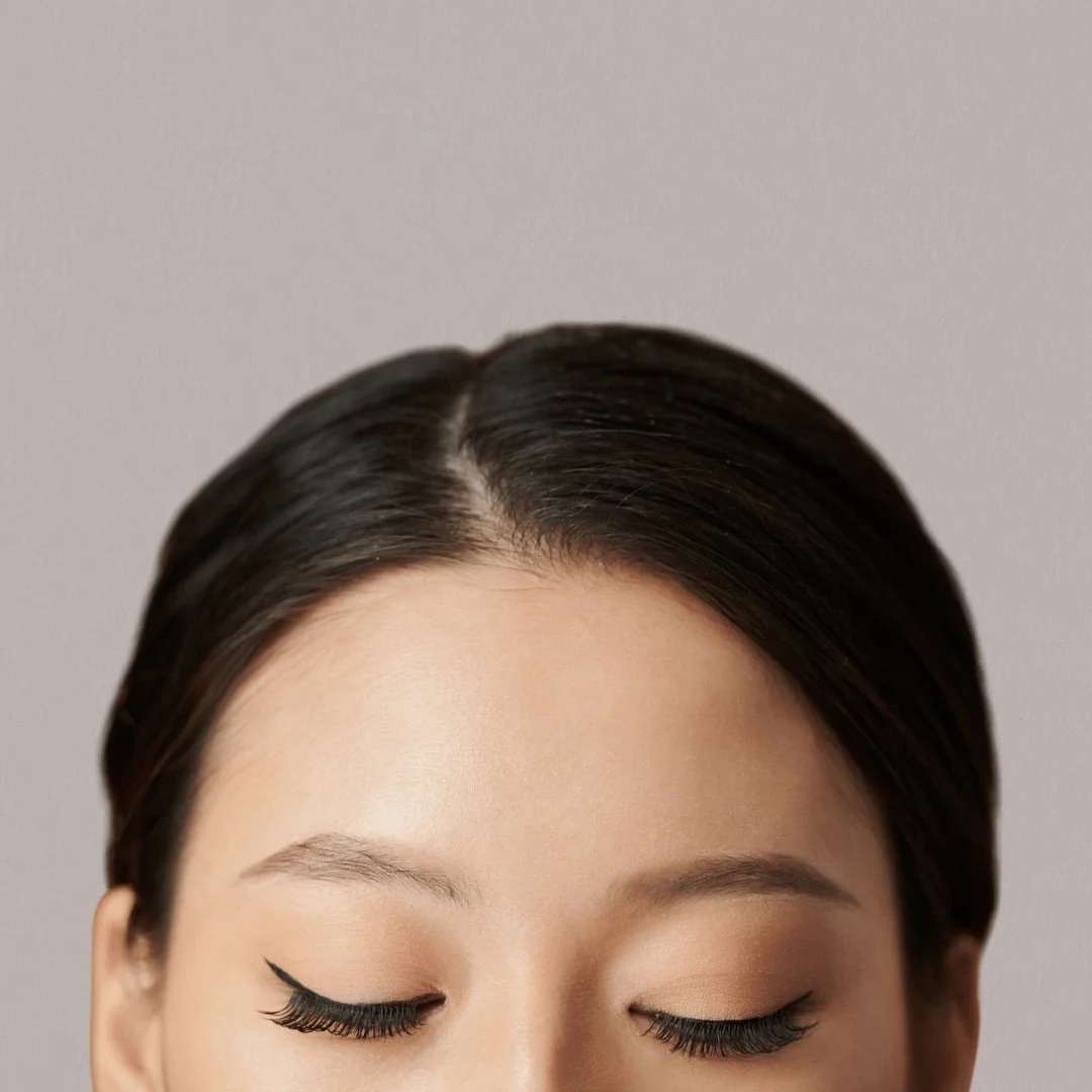 Upper Face Wrinkle Treatment with Xeomin & Botox