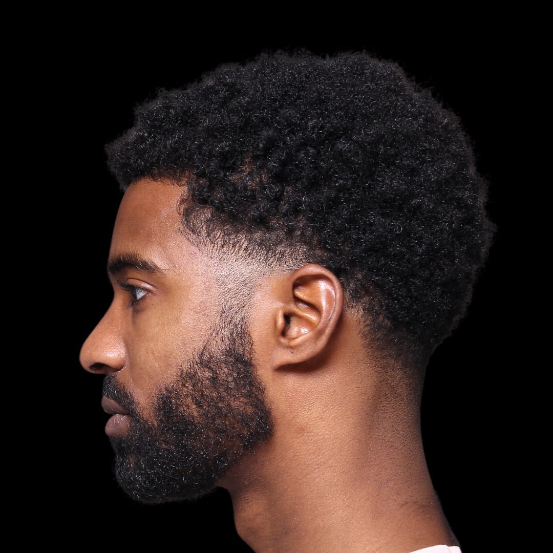 Masseter Botox for jaw clenching relief and jawline definition