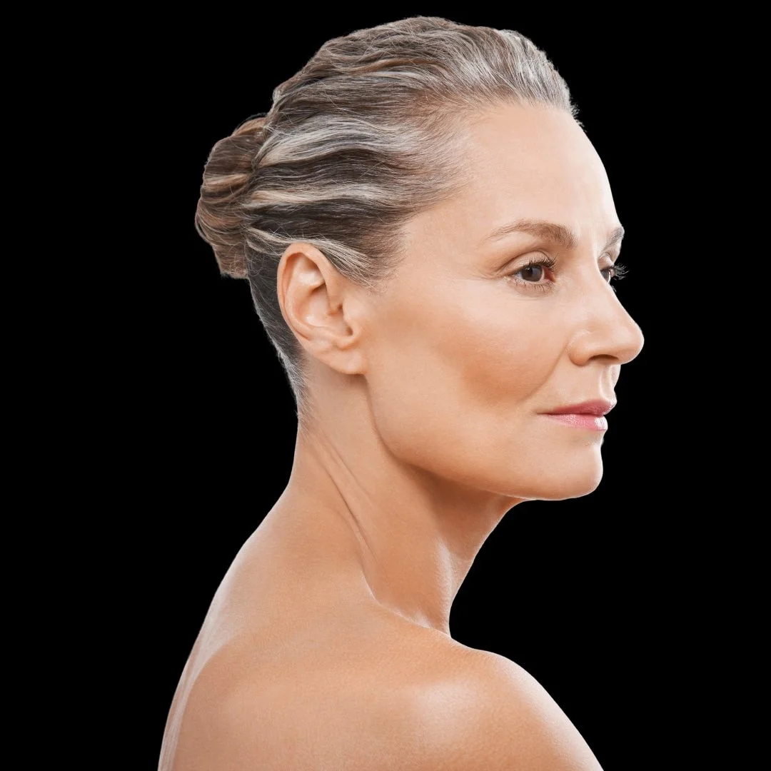 Trap Botox treatment focused on the trapezius muscles