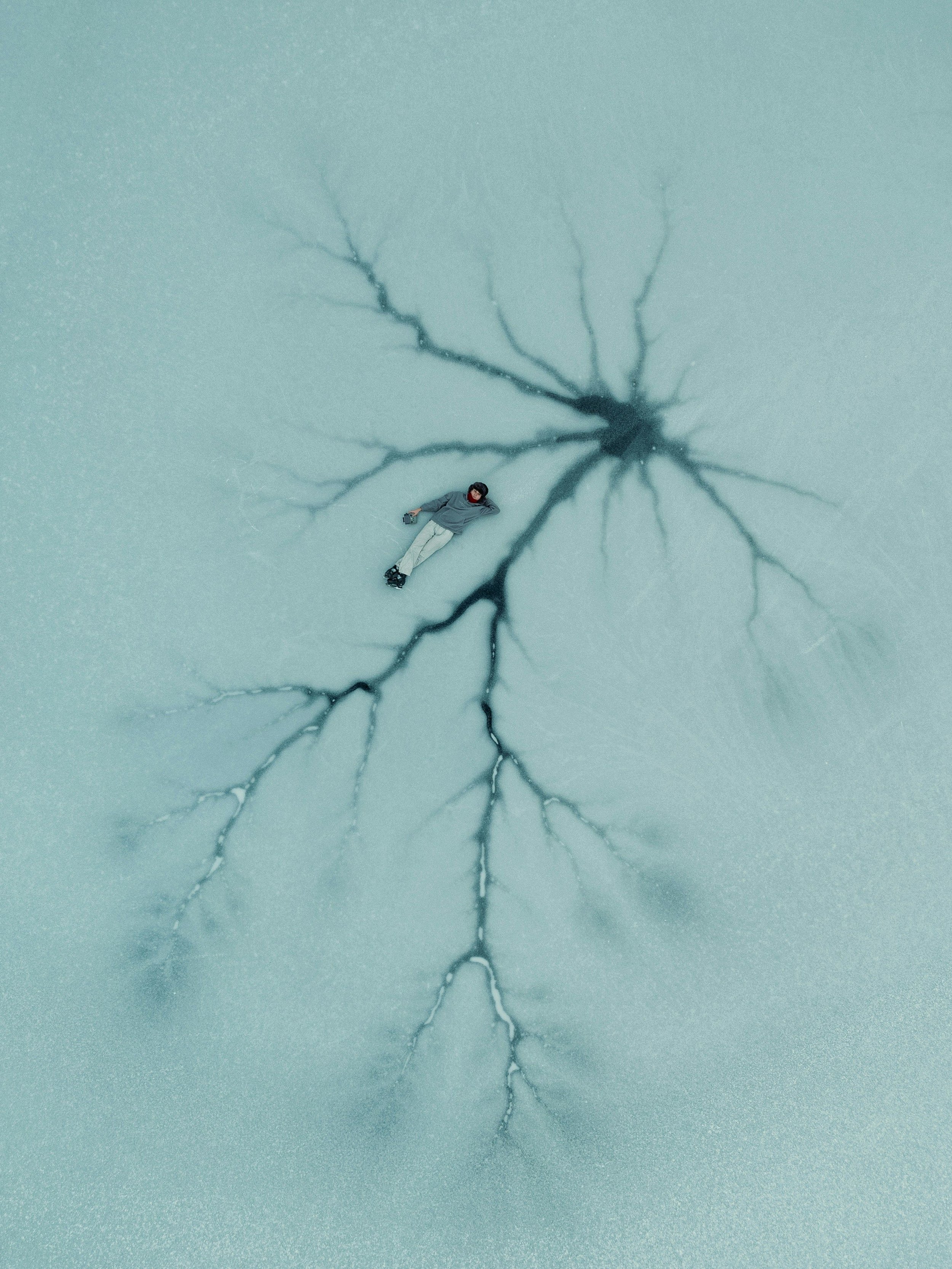 Neuroplasticity