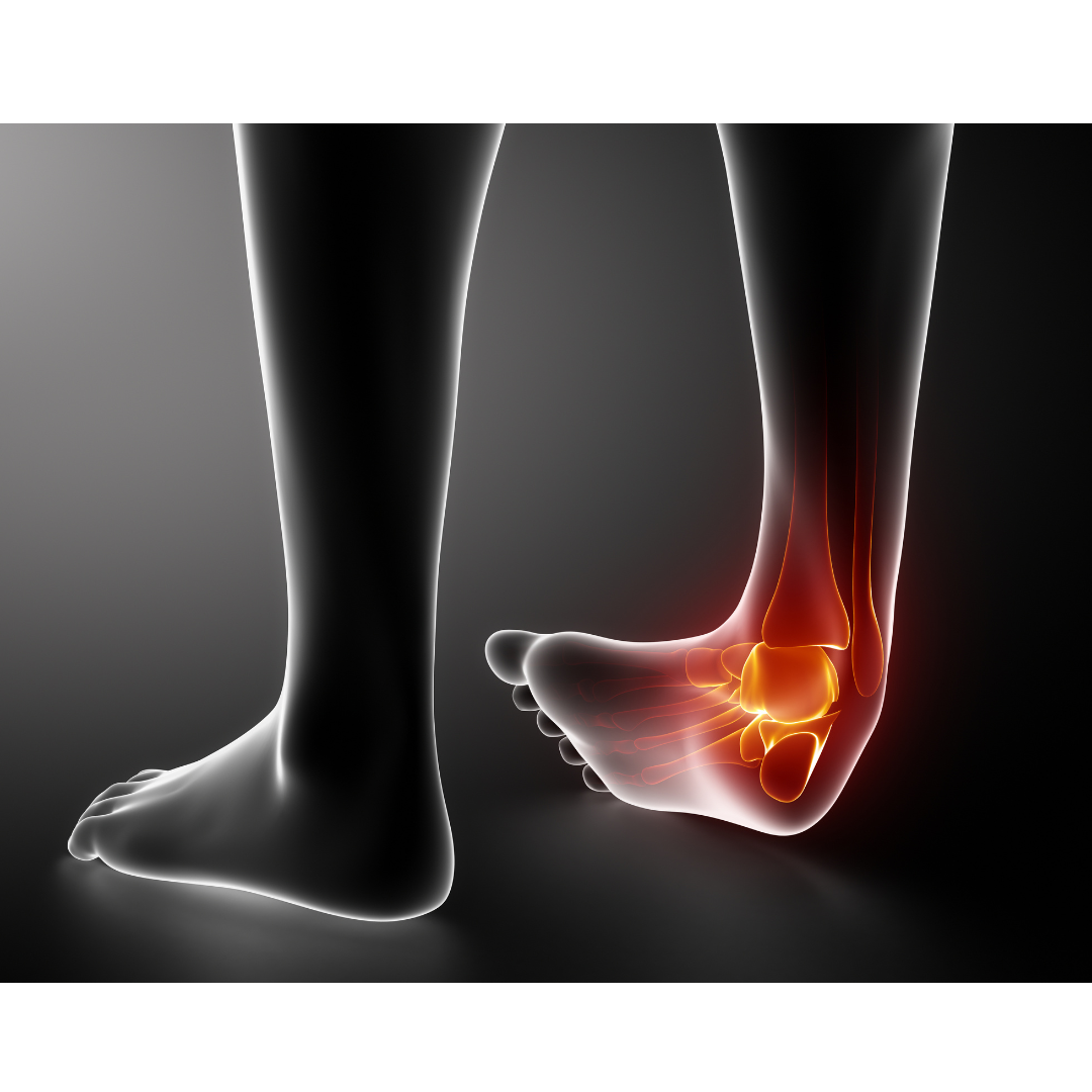 Game Ready Cold Therapy for Ankle Sprain — Valor Durable Medical ...