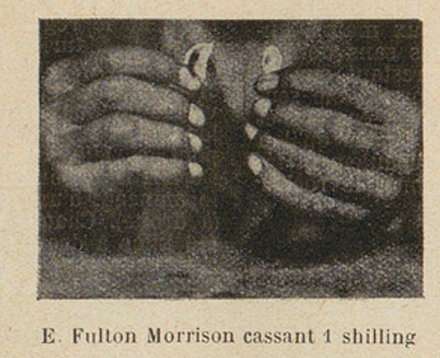 E. Fulton Morrison cassant 1 shilling. La Santé par les Sports, 1 February 1912. Image created by the Bibliothèque nationale de France, accessed via Gallica. Public domain.