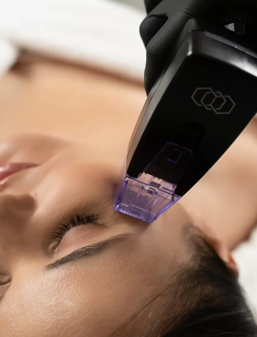 Med Spa in North Haven, CT 06473, USA | RF Microneedling Near Me