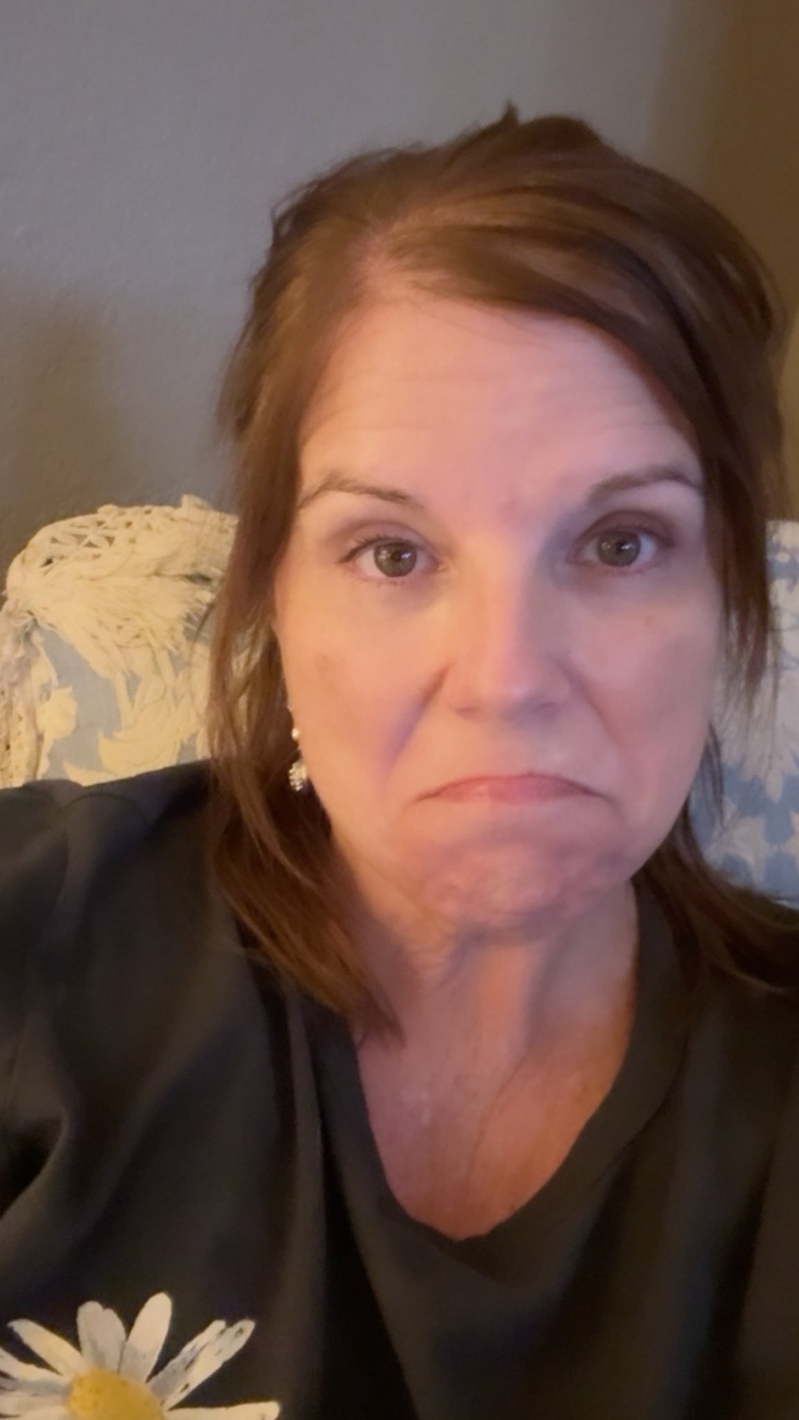 I don&rsquo;t have a fun story. 

I was at the waterpark with the boys, bent down to pick up their shoes, and underestimated the distance of the curb in front of me. 

The next thing I knew, I was on the ground cozying up to the rocks.

And that&rsqu