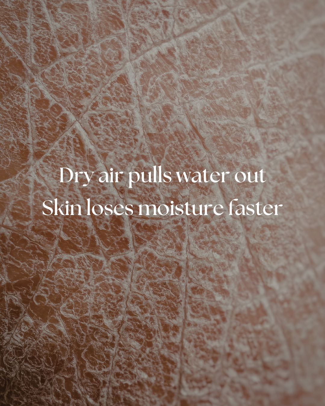 Dry skin close-up. "Dry Air pulls water out. Skin loses moisture faster"