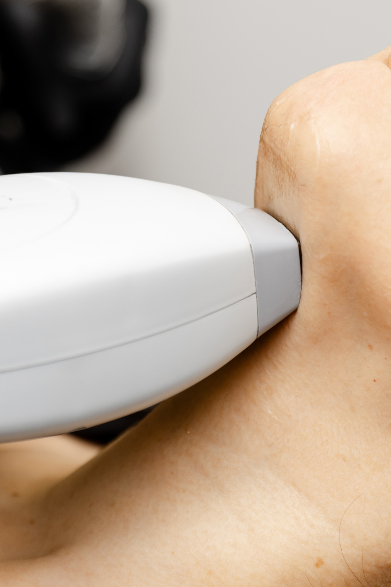 The Ultimate Guide to Laser Hair Removal in Cambridge &amp; Mississauga
