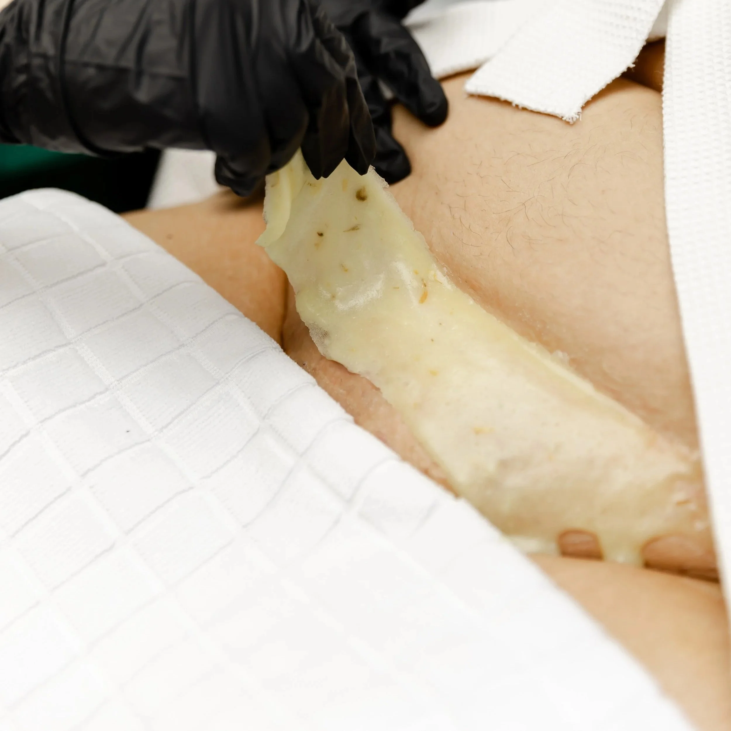 Close-up of an intimate facial treatment, beauty professional removing mask on bikini area of client with a white towel covering intimate areas.