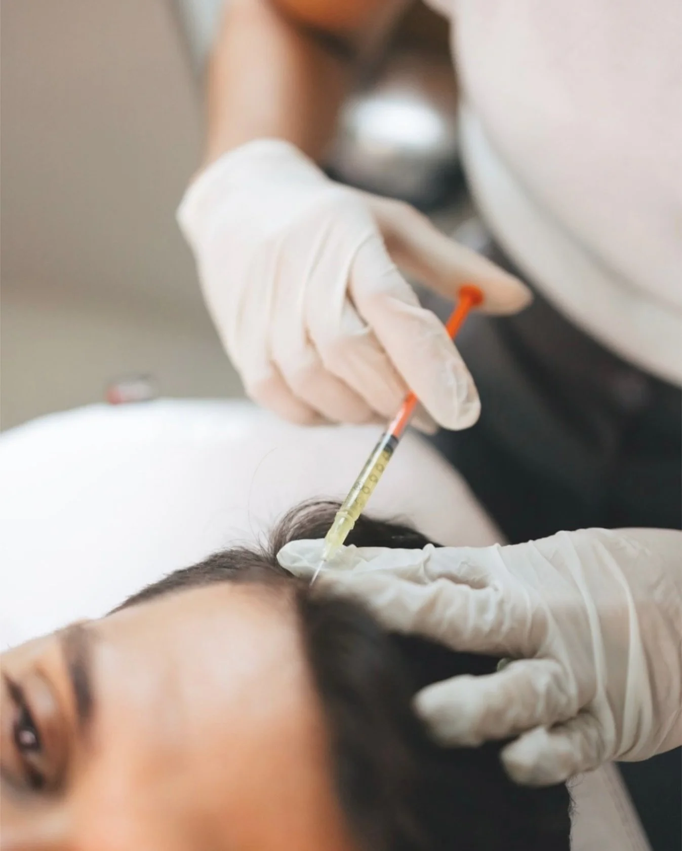 Le PRP?

C&rsquo;est un soin 100% naturel &agrave; base de votre propre sang 🩸
On en extrait le plasma riche en plaquettes pour le r&eacute;injecter dans le cuir chevelu ➡️ il stimule les follicules pileux et relance la repousse capillaire 🌟

&bull