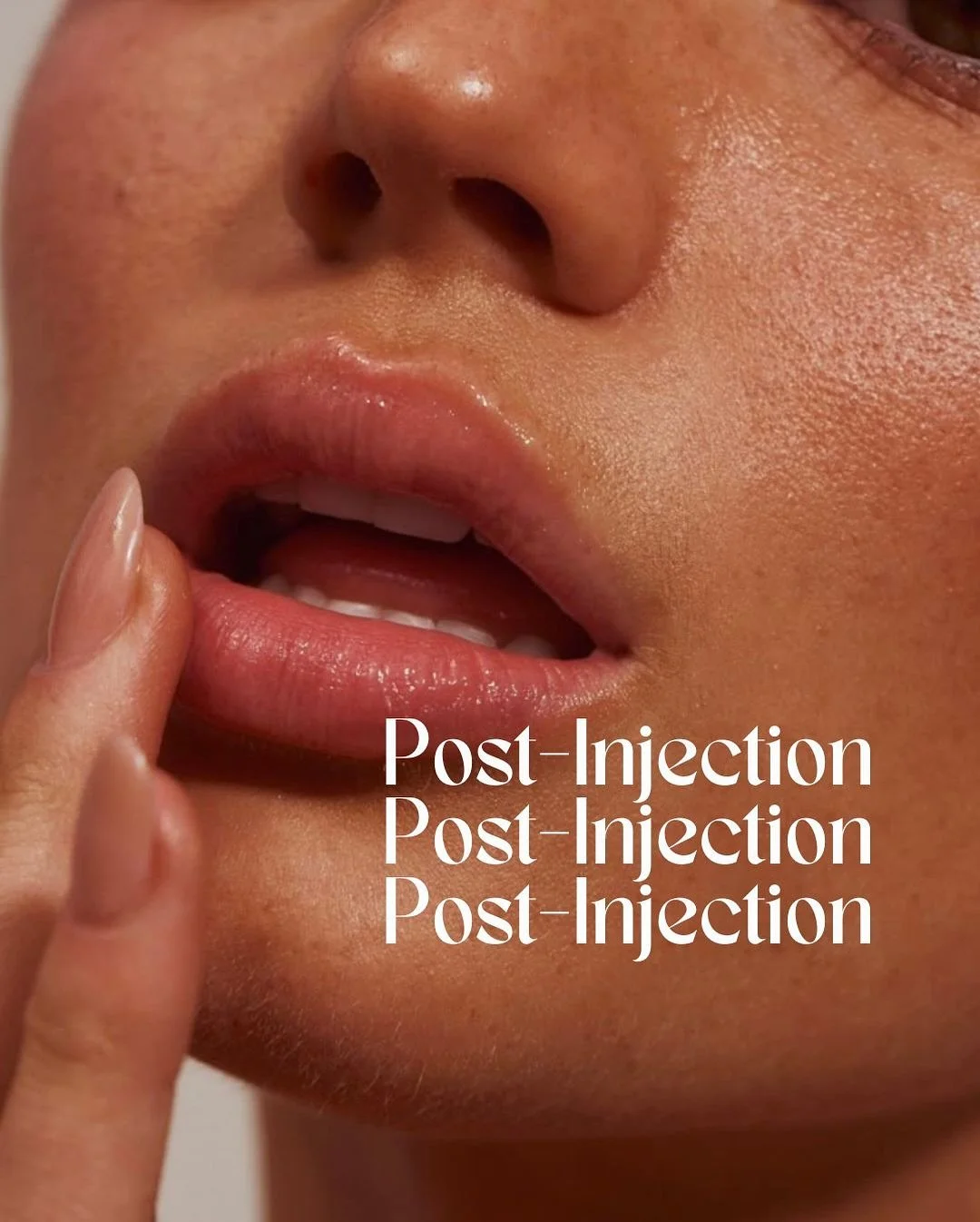 Envie de l&egrave;vres naturellement pulpeuses ?
Les injections d&rsquo;acide hyaluronique offrent un r&eacute;sultat imm&eacute;diat et harmonieux ✨

➡️ R&eacute;sultat visible d&egrave;s la fin de la s&eacute;ance

⏳ R&eacute;sultat final sous 5 &a