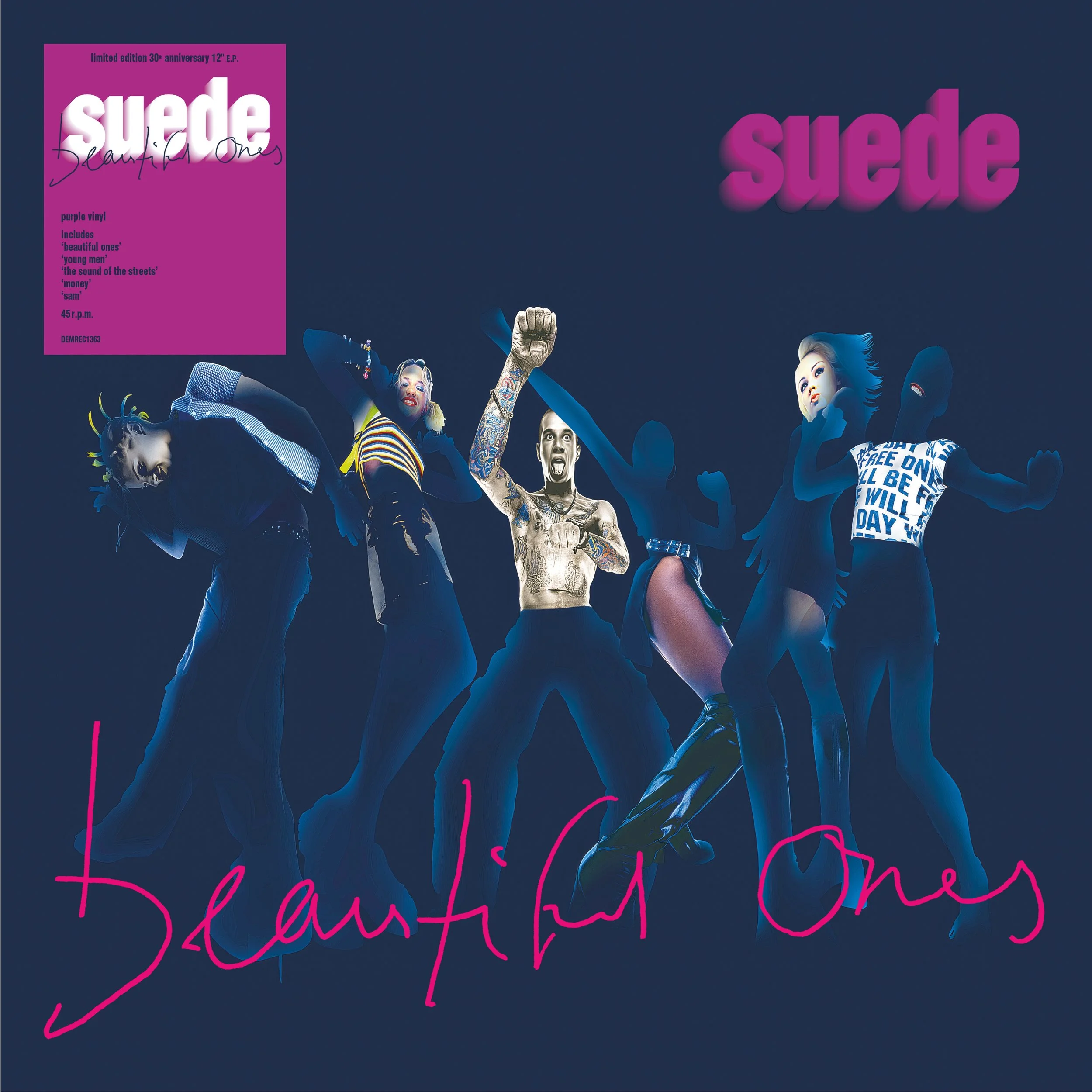 SUEDE - BEAUTIFUL ONES [2026]