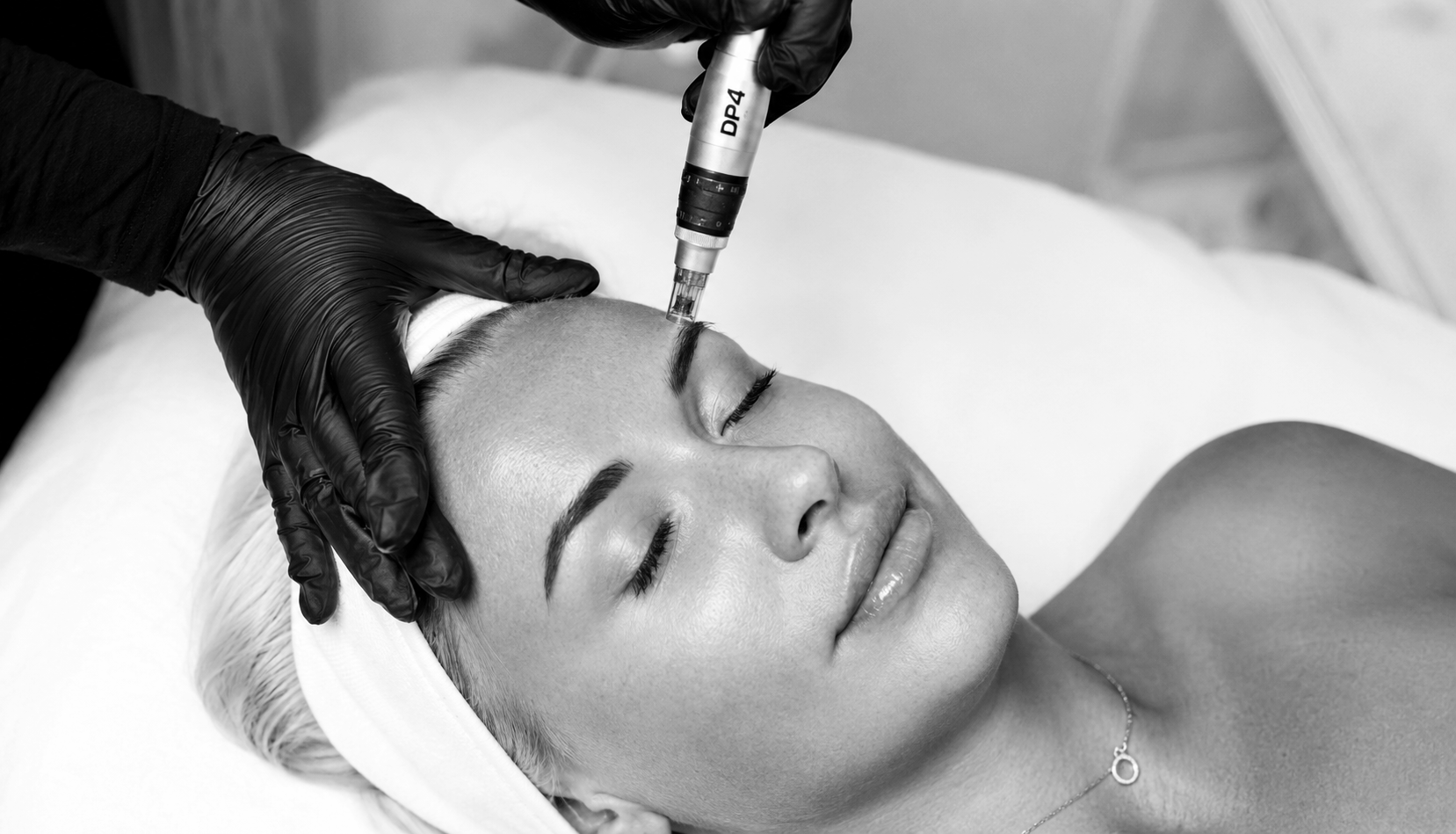 A woman with white hair band receiving a facial treatment with a microneedling device in a spa or clinic setting, lying on a treatment bed with her eyes closed.