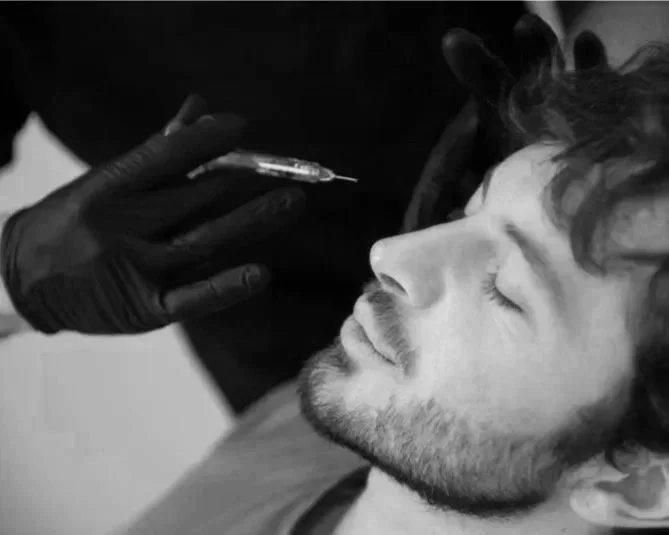 A young man with curly hair and a beard receiving a botox injection in his forehead from a healthcare professional wearing a glove.