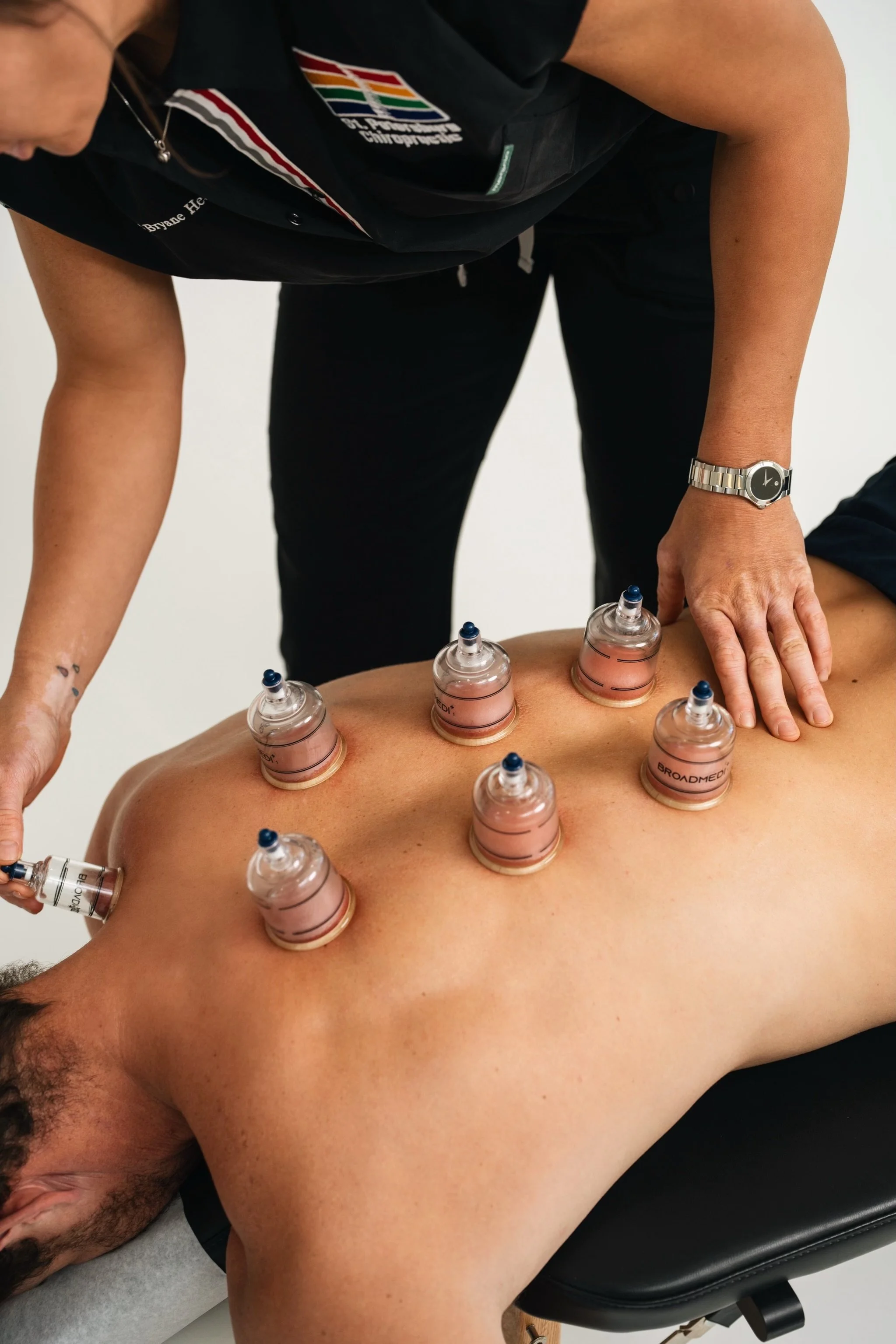 Doctor Bryane Heaberlin Cupping on back at St. Petersburg Chiropractic Florida