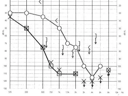 Warum es kustik gibt – und was das mit *mir* zu tun hat