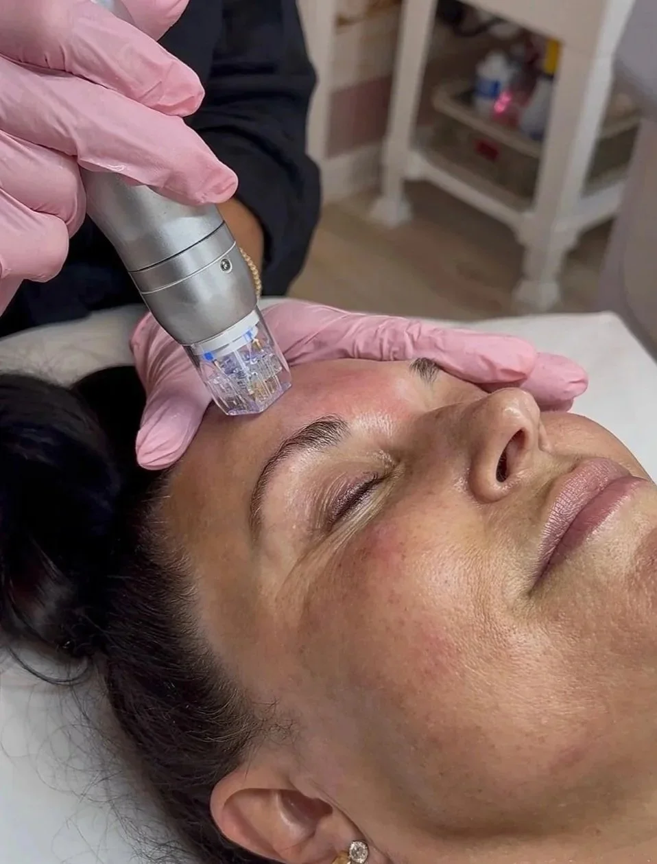 Microdermabrasion.jpg