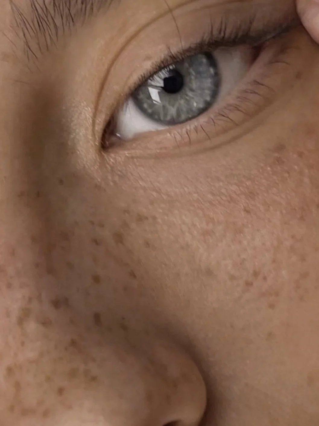 FRECKLE MASTER CLASS