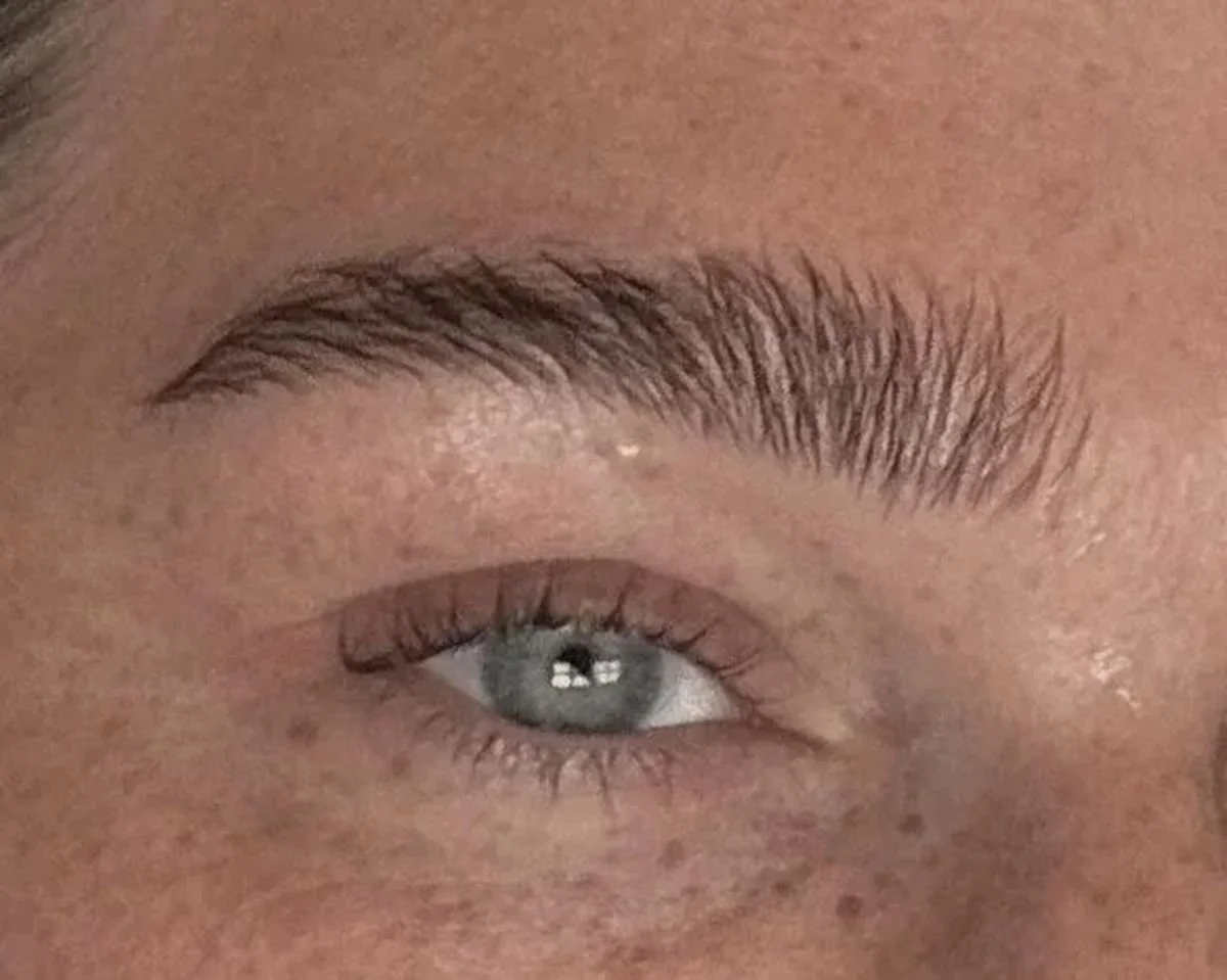 Brow Lift Ergebnis Chi Chi Club Hamburg