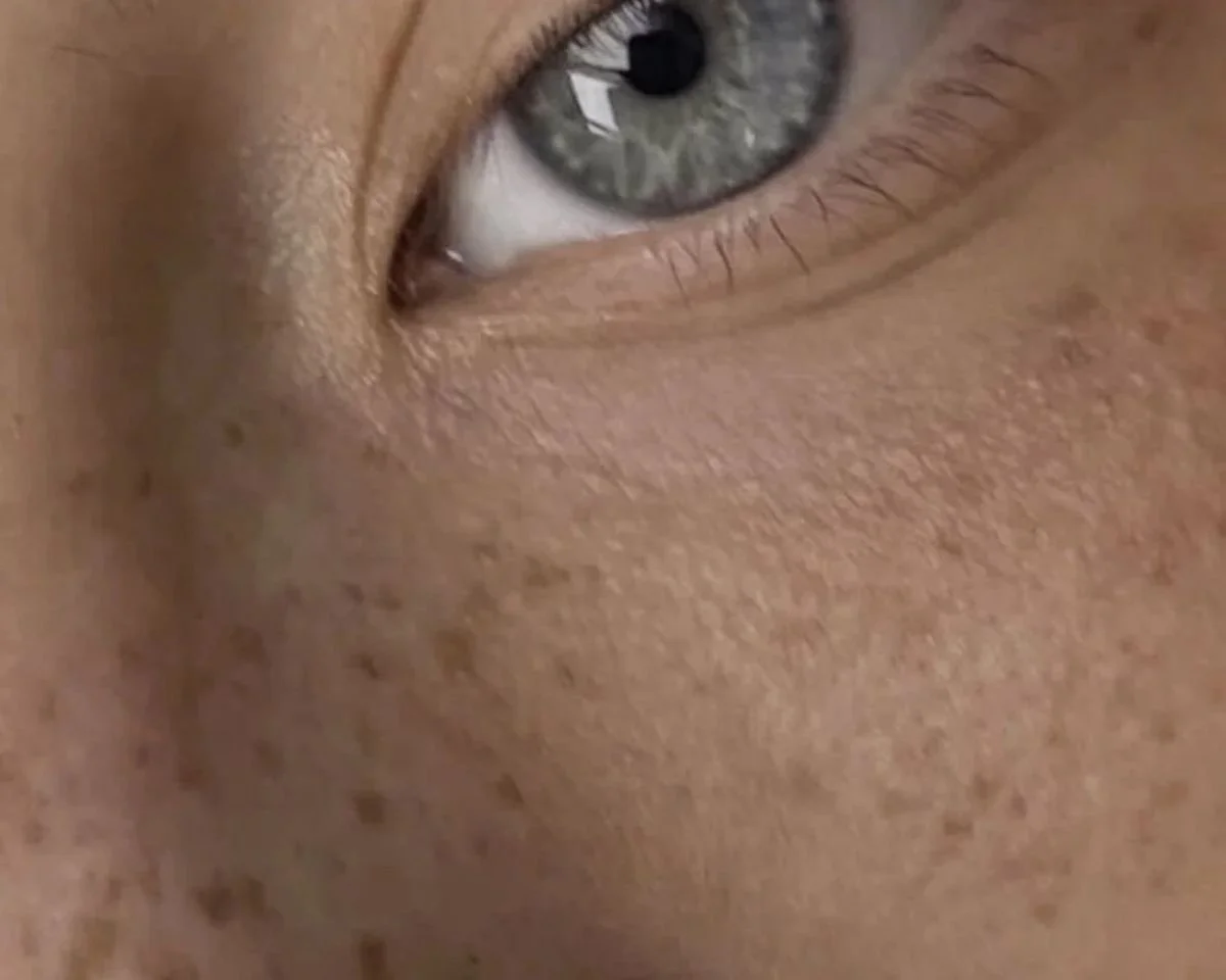 Super natürliches Freckles Sommersprossen Tattoo Chi Chi Club Hamburg