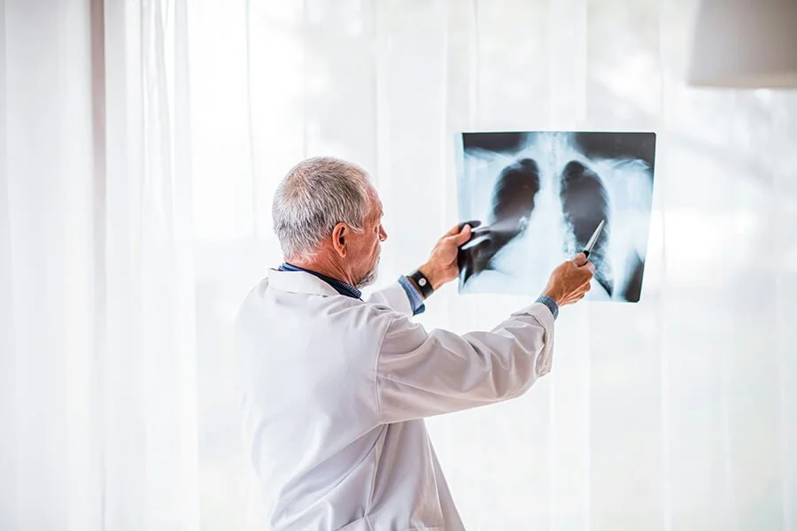 Healthcare provider reviewing a chest X-ray, representing diagnostic X-ray services at North Runnels Hospital District.