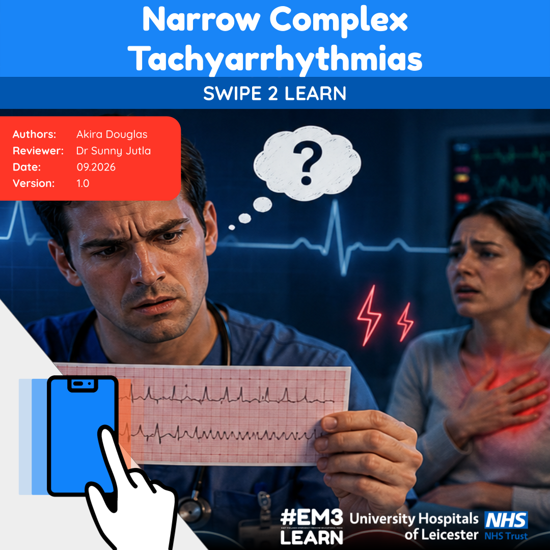 Tachyarrhythmias Swipe to Learn.png