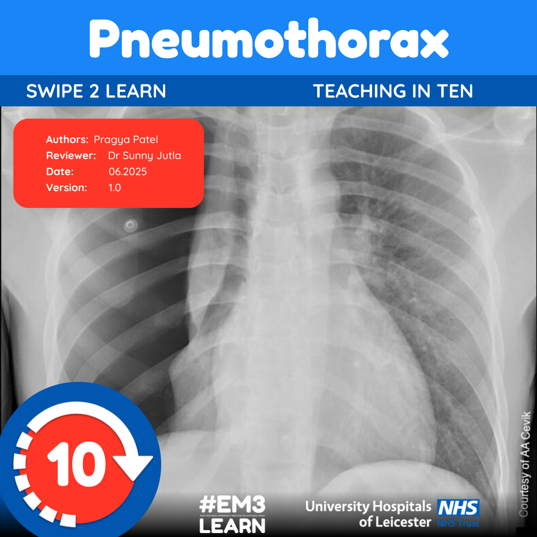 Pneumothorax