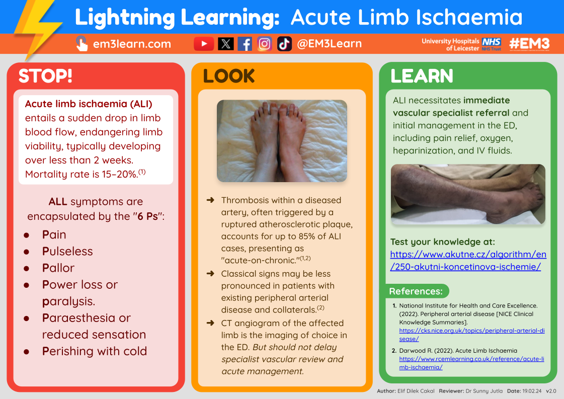Acute Limb Ischaemia