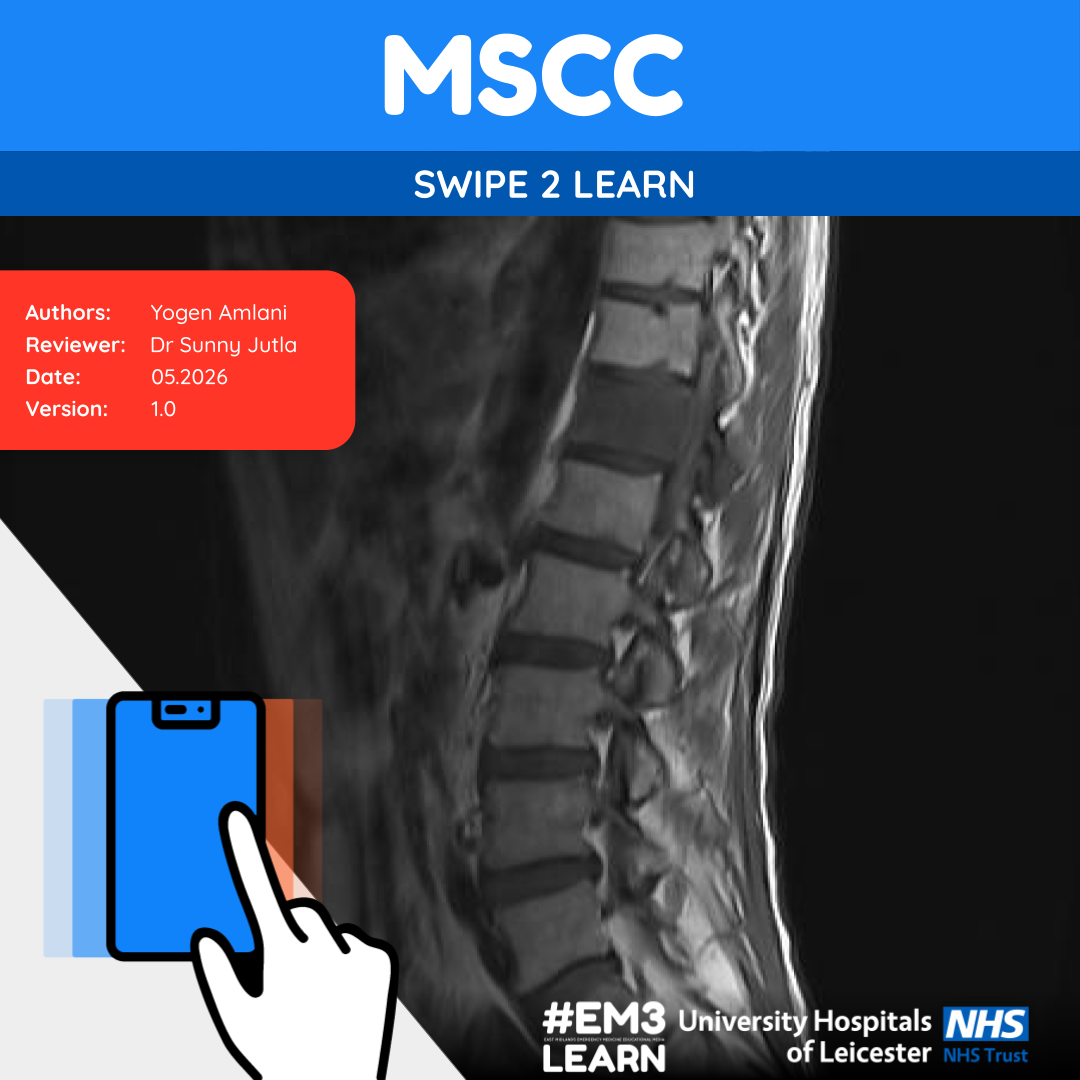 MSCC